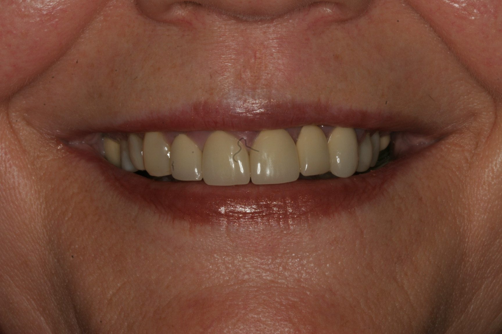 EF-Smile-B4
