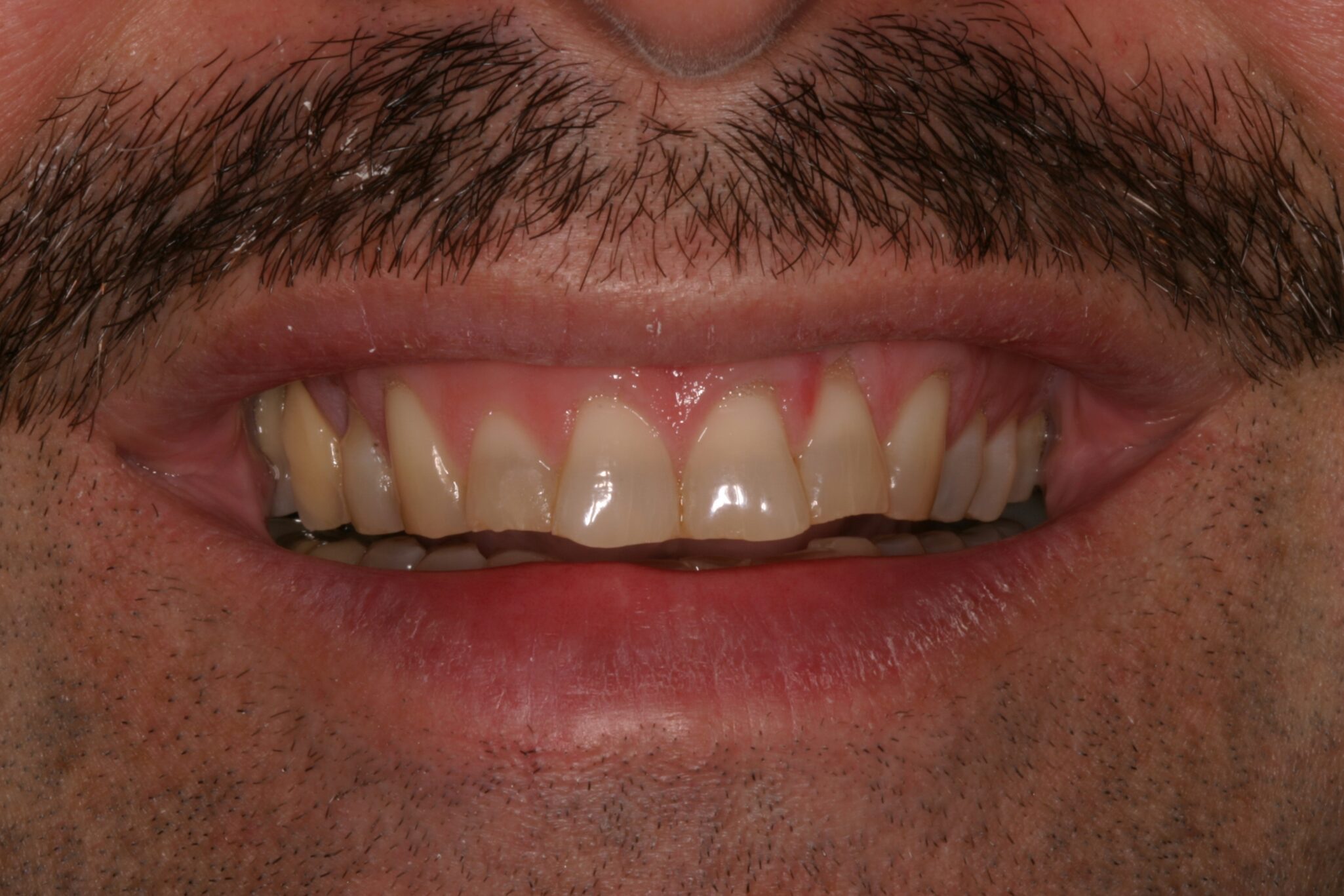 JA-Smile-B4