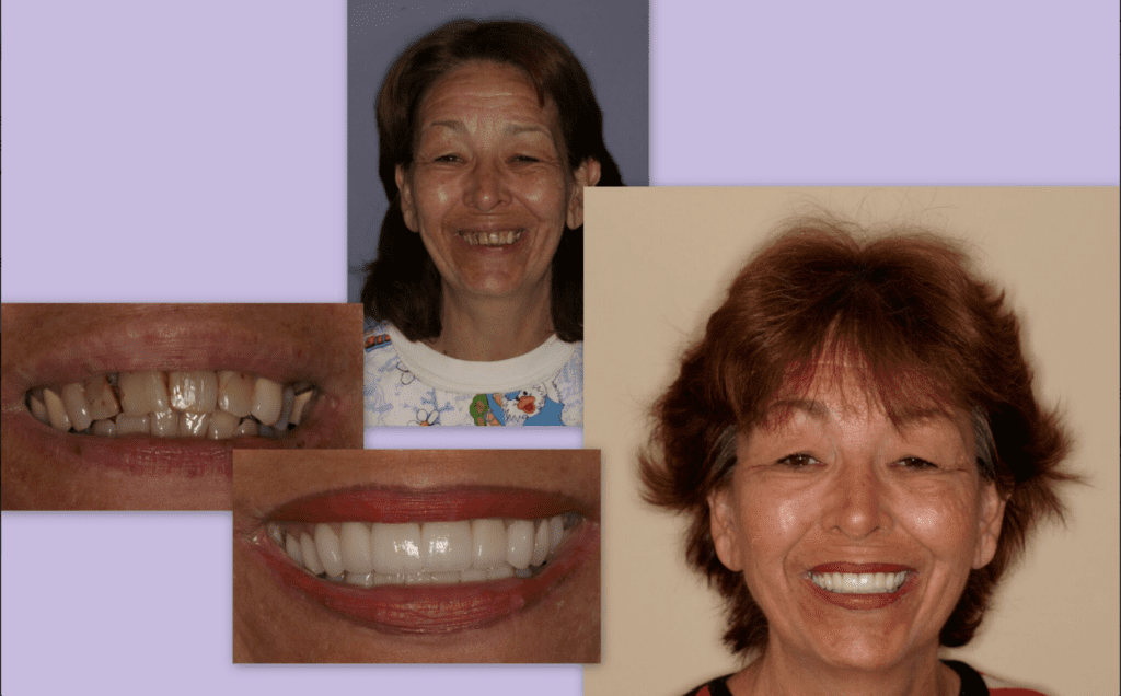 Dr. Ban R. Barbat - Cosmetic Dentistry